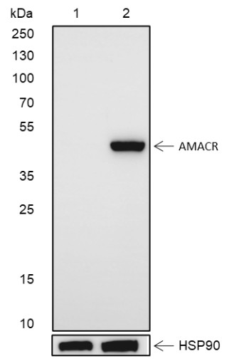 Recombinant AMACR Monoclonal Antibody-searchlist-1