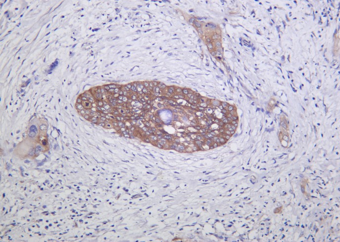 Recombinant Integrin α2 Monoclonal Antibody-searchlist-1