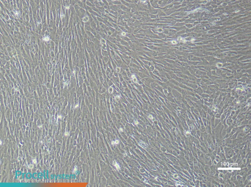 Human Ovarian Cancer Fibroblast (Primary cell immortalization) Complete Medium - 3