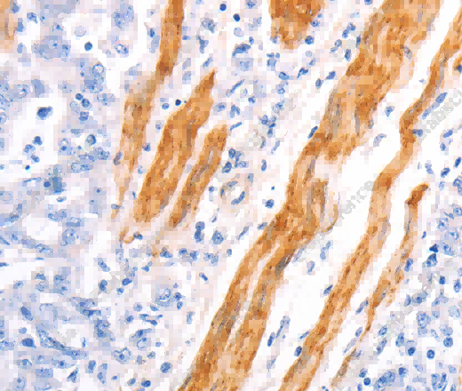 TPM1 Polyclonal Antibody - 2
