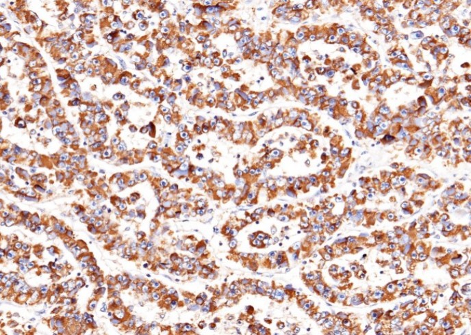 SerpinD1 Monoclonal Antibody - small - 2