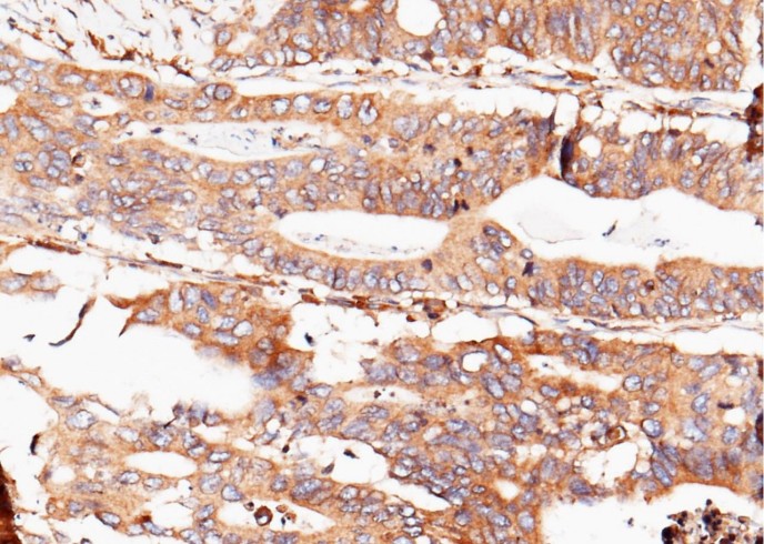 Recombinant Transferrin Receptor/TFRC/CD71 Monoclonal Antibody - small - 2