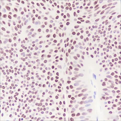 Recombinant HMGA1 Monoclonal Antibody - small - 4