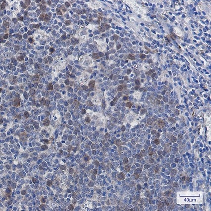 Recombinant Securin Monoclonal Antibody - 2