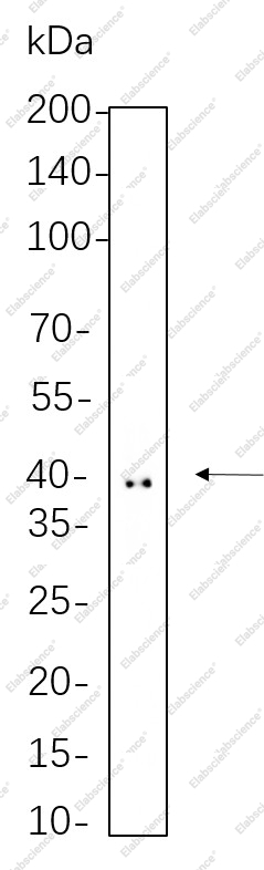 Recombinant Doublecortin Monoclonal Antibody - 1