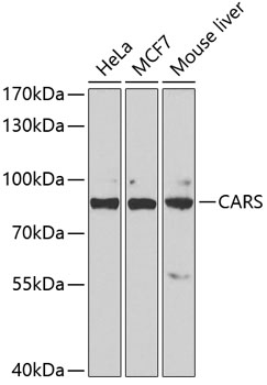 Western blot analysis of extracts of various cell lines using CARS Polyclonal Antibody at 1:1000 dilution.