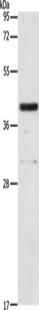 Western Blot analysis of 231 cell using PAFAH2 Polyclonal Antibody at dilution of 1:700