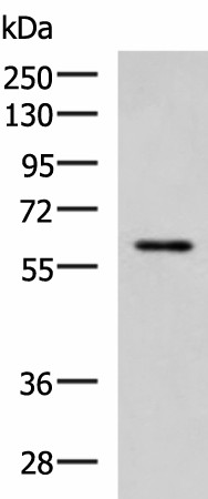 Western blot analysis of MCF7 cell lysate  using ECM1 Polyclonal Antibody at dilution of 1:1000