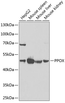 Western blot analysis of extracts of various cell lines using PPOX Polyclonal Antibody at 1:1000 dilution.