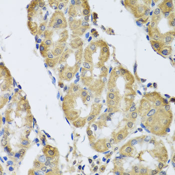 Immunohistochemistry of paraffin-embedded human stomach using CAMK2G Polyclonal Antibody at dilution of 1:100 (40x lens).Perform microwave antigen retrieval with 10 mM PBS buffer pH 7.2 before commencing with IHC staining protocol.