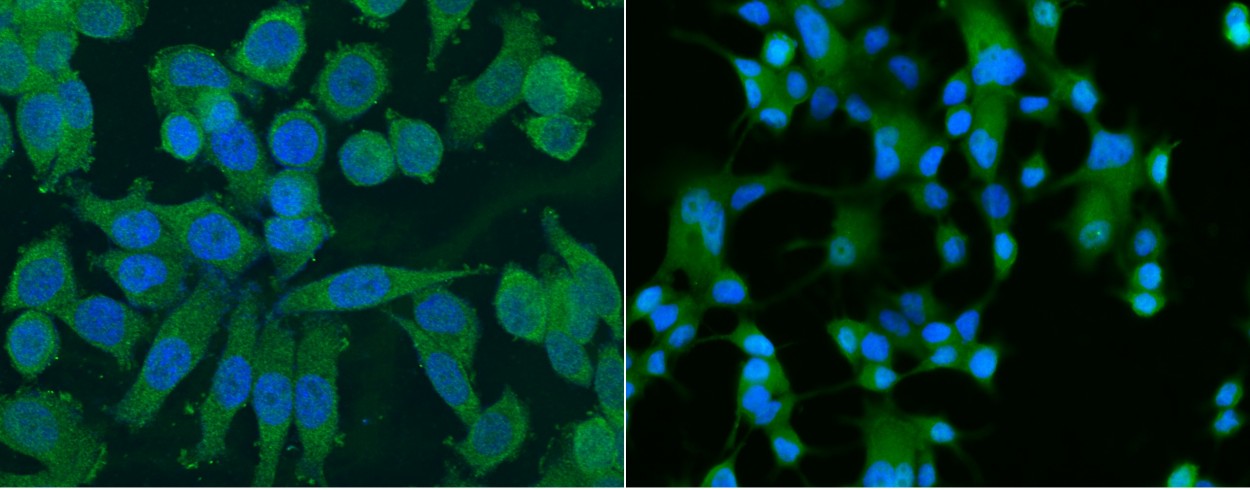 ALDH1/ALDH1A1/ALDC Monoclonal Antibody - small - 2