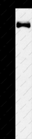 SLIT2 Polyclonal Antibody - 1