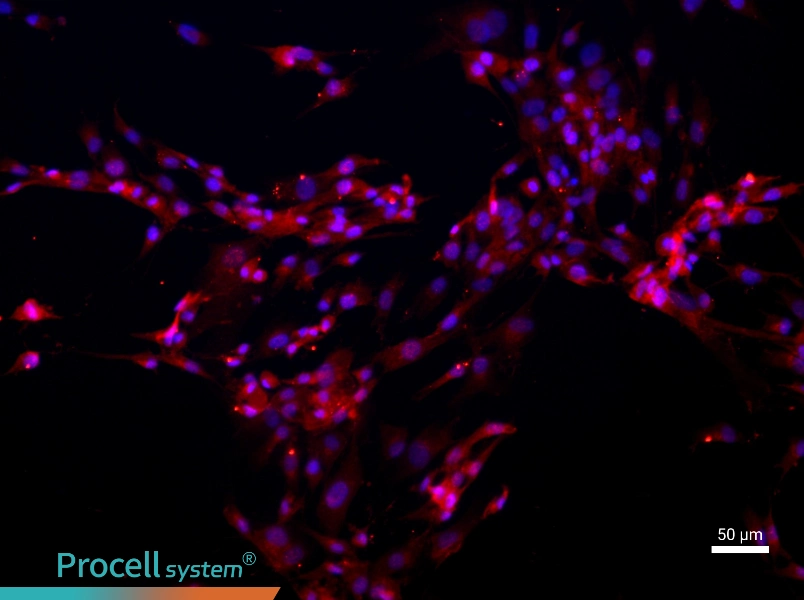 Human Intervertebral Disc Nucleus Pulposu Cell Complete Medium - 1
