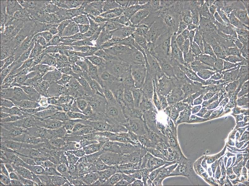 NCI-H2444 Cell Complete Medium - small - 5