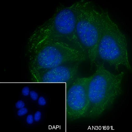 Recombinant GRP75 Monoclonal Antibody - 2