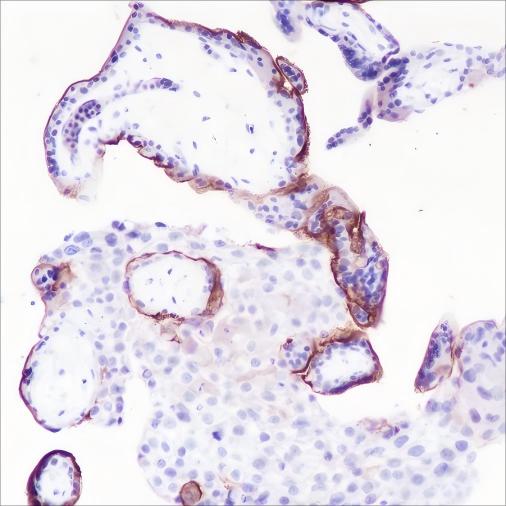 Recombinant Thrombomodulin Monoclonal Antibody - small - 2