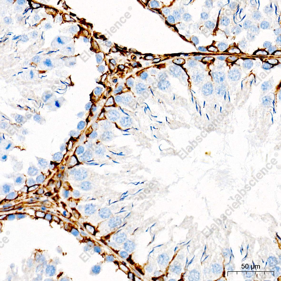 (KO Validated) Vimentin Polyclonal Antibody - 8