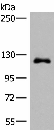 Western blot analysis of A375 cell lysate  using ARHGAP45 Polyclonal Antibody at dilution of 1:700