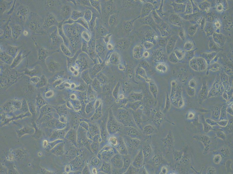 IGROV-1 Cell Complete Medium - 4