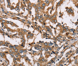 HSD17B12 Polyclonal Antibody - 2