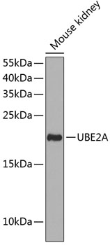Western blot analysis of extracts of Mouse kidney using UBE2A Polyclonal Antibody at dilution of 1:1000.