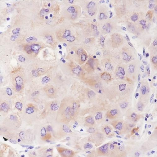 Recombinant ABAT Monoclonal Antibody - 2