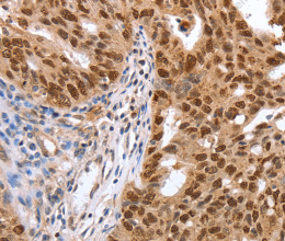 PARP1 Polyclonal Antibody - 2