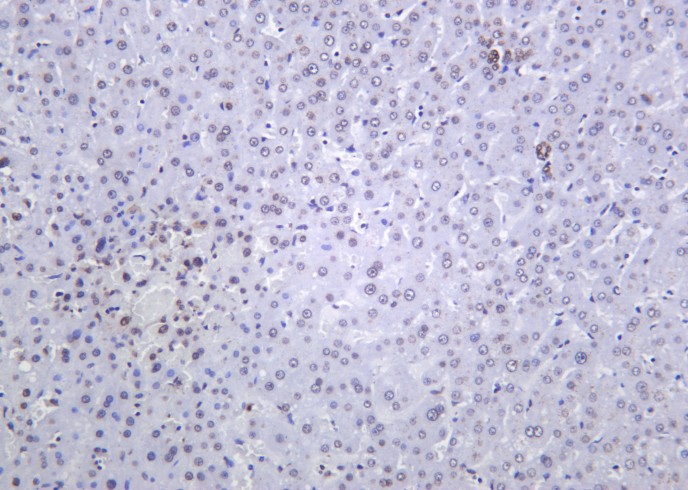 Recombinant Histone H4 (Tri Methyl Lys20) Monoclonal Antibody-searchlist-1