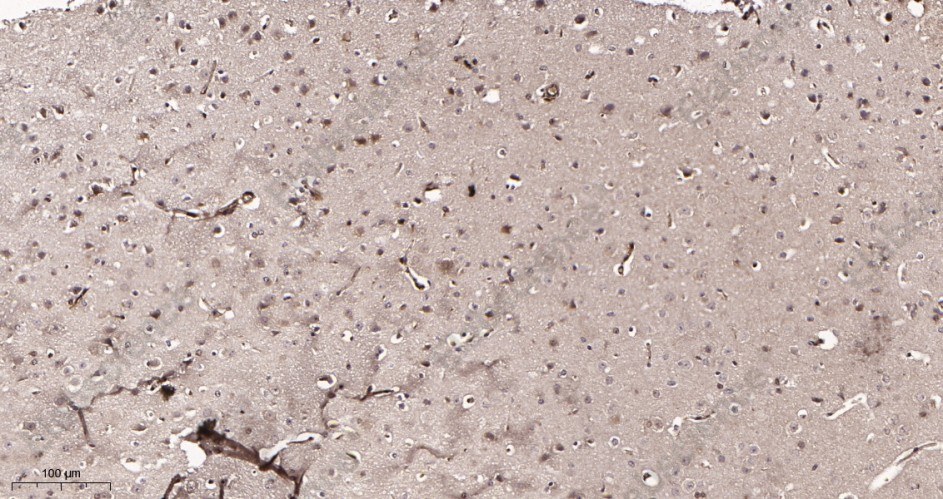 Recombinant Hsp70 Monoclonal Antibody - 3
