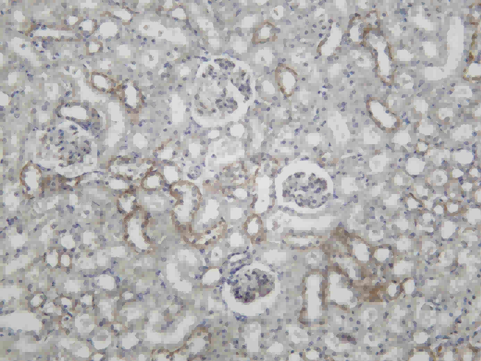 Recombinant N WASP Monoclonal Antibody - 2
