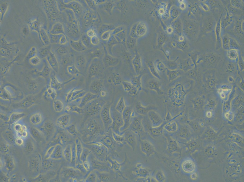 IGROV-1 Cell Complete Medium - 5