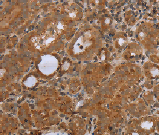 NDUFS2 Polyclonal Antibody - 3