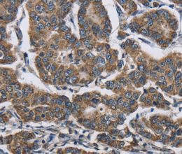 RAGE Polyclonal Antibody - 2