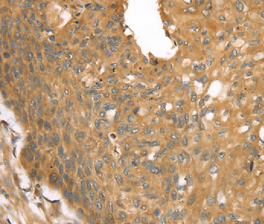 STX16 Polyclonal Antibody - 2