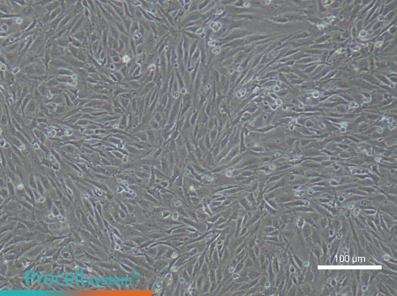Human Lymphatic Endothelial Cell Complete Medium - 2