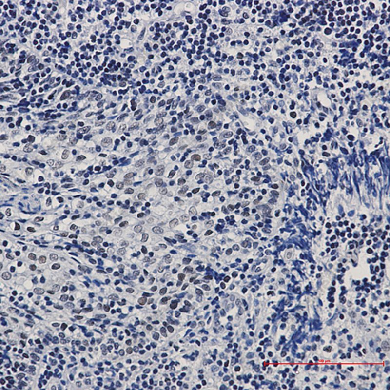 Recombinant CTBP1 Monoclonal Antibody - 4