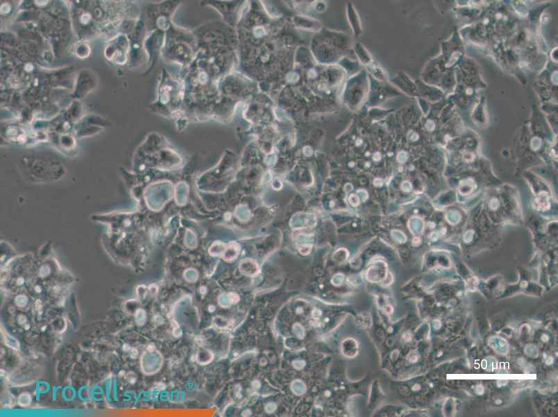 OE19 Cell Complete Medium - small - 4