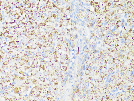 Immunohistochemistry of paraffin-embedded Rat ovary using mTOR Polyclonal Antibody at dilution of 1:150 (40x lens).