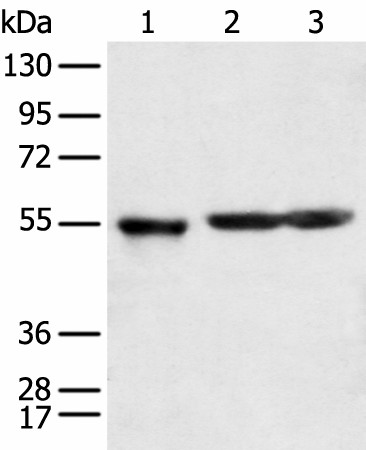 Western blot analysis of Human cerebrum tissue rat brain tissue and Mouse brain tissue  using KCTD16 Polyclonal Antibody at dilution of 1:350