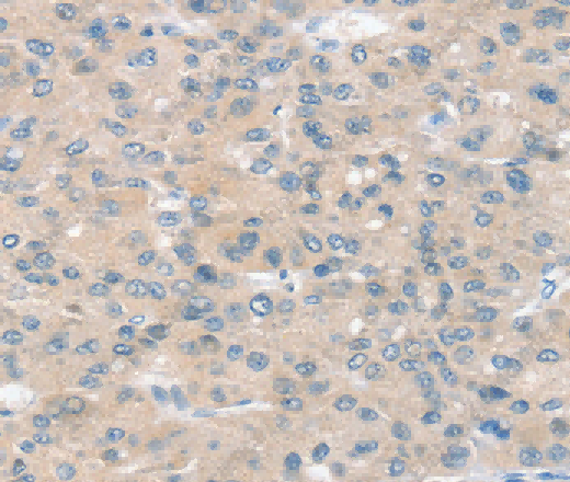 SLIT2 Polyclonal Antibody - 2