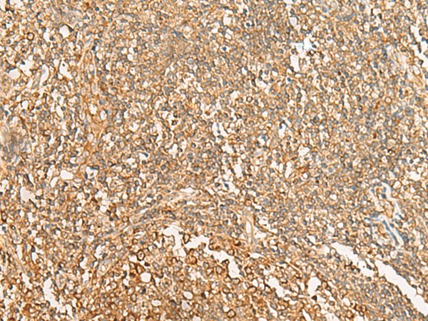 Immunohistochemistry of paraffin-embedded Human tonsil tissue  using NARS Polyclonal Antibody at dilution of 1:30(?200)