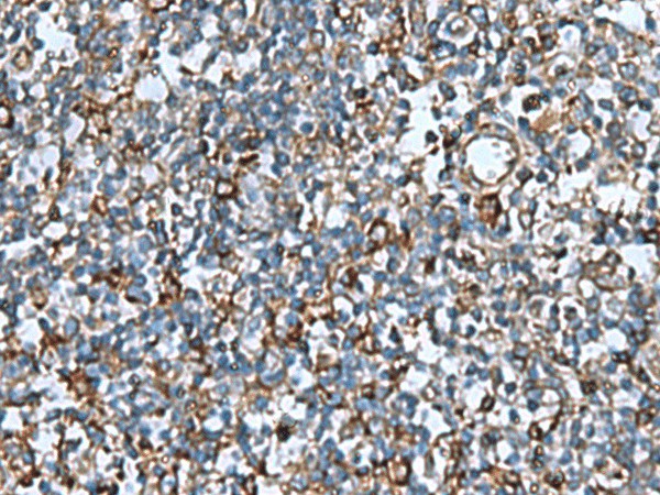 Immunohistochemistry of paraffin-embedded Human tonsil tissue  using COMMD9 Polyclonal Antibody at dilution of 1:60(?200)