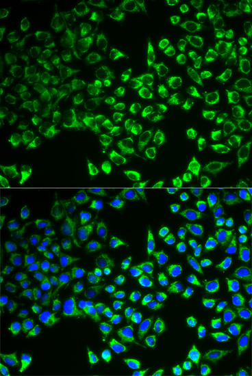 Immunofluorescence analysis of MCF-7 cells using CS Polyclonal Antibody