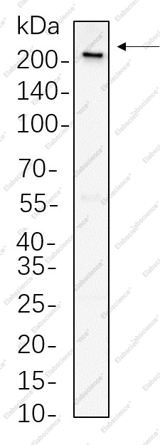 Recombinant Rpb1 Monoclonal Antibody - 1