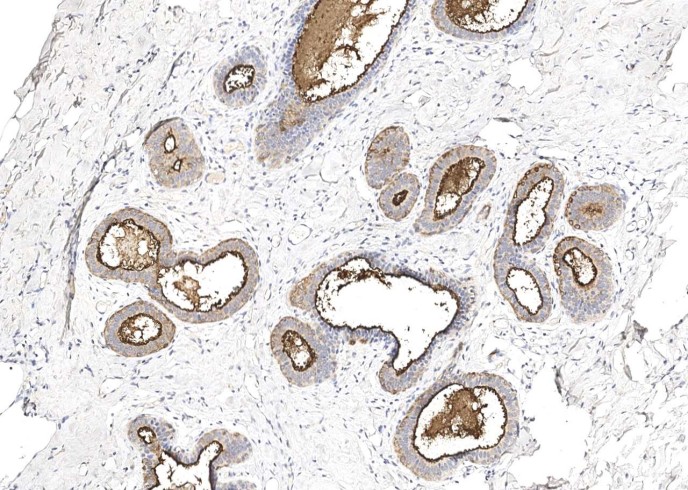 Recombinant MUC1 Monoclonal Antibody-searchlist-1