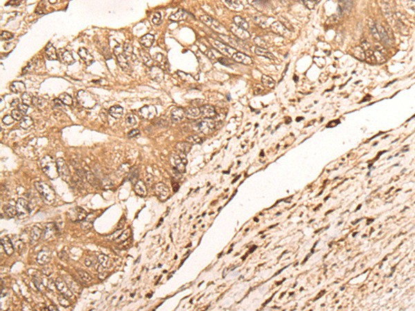 MAGEA1 Polyclonal Antibody - small - 2