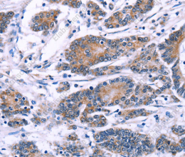 SYT4 Polyclonal Antibody - 2