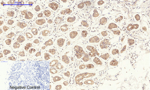 Immunohistochemistry of paraffin-embedded Human stomach tissue using NOS3 Polyclonal Antibody at dilution of 1:200.