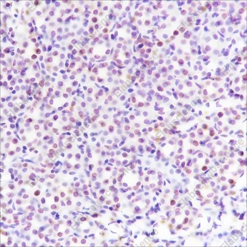 Recombinant Ataxin-3 Monoclonal Antibody - 3