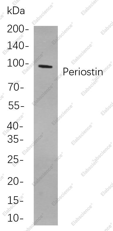 Recombinant Periostin Monoclonal Antibody - 1